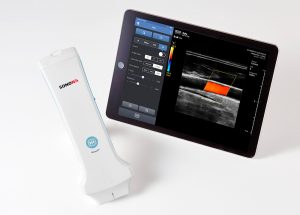 SONON 300L　超音波画像診断装置